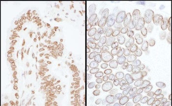 Lamin-A/C Antibody