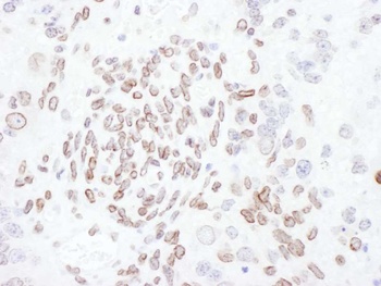 Rabbit anti-Lamin-A/C Antibody