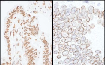 Rabbit anti-Lamin-A/C Antibody