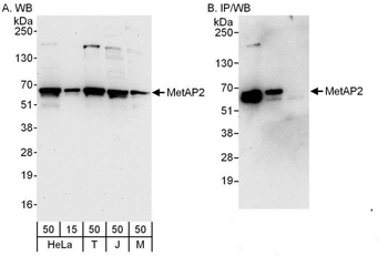 Rabbit MetAP2 Antibody