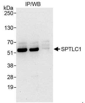Rabbit anti-SPTLC1 Antibody