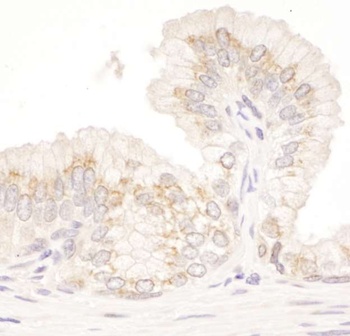 Rabbit GM130 Antibody