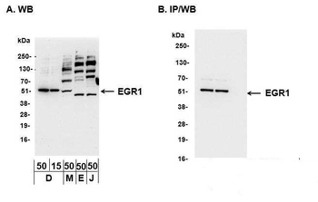 Rabbit EGR1 Antibody