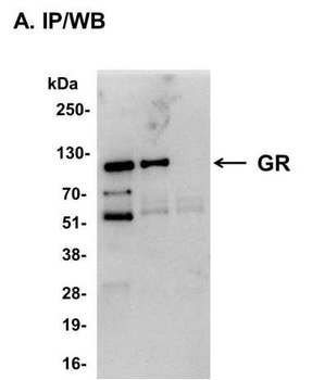 Rabbit GR Antibody