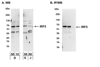 Rabbit IRF5 Antibody