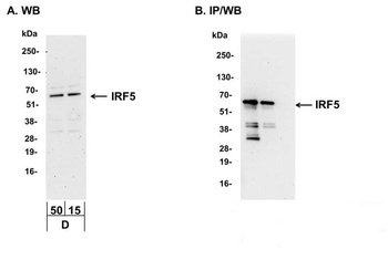 Rabbit IRF5 Antibody