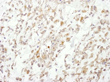 Rabbit Cul1 Antibody