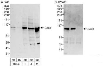 Rabbit Sec3 Antibody