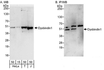 Rabbit Dysbindin1 Antibody