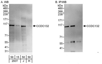 Rabbit CCDC132 Antibody