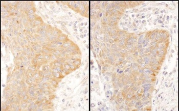 Rabbit anti-IGF2BP2 Antibody