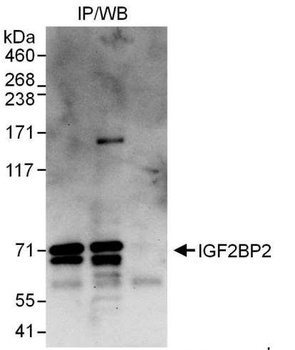Rabbit IGF2BP2 Antibody