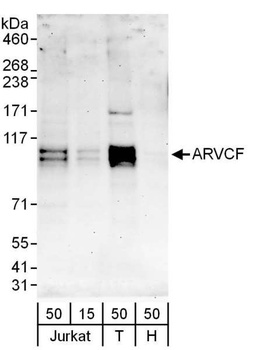 Rabbit ARVCF Antibody