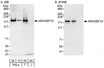 Rabbit ARHGEF10 Antibody
