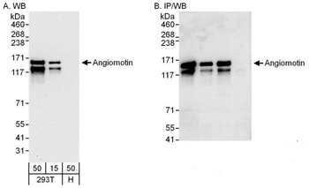 Rabbit Angiomotin Antibody