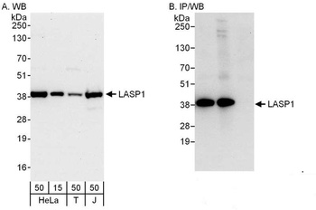 Rabbit LASP1 Antibody