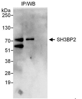 Rabbit SH3BP2 Antibody