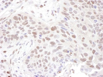 ZNF462 Antibody