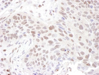 Rabbit anti-ZNF462 Antibody