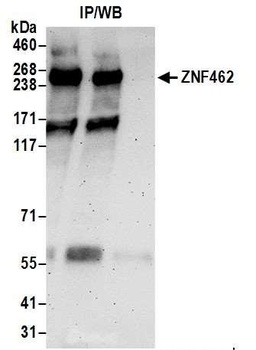 Rabbit anti-ZNF462 Antibody
