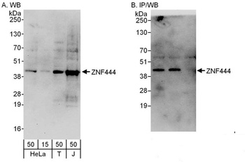 Rabbit ZNF444 Antibody