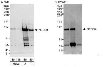 Rabbit NEDD4 Antibody