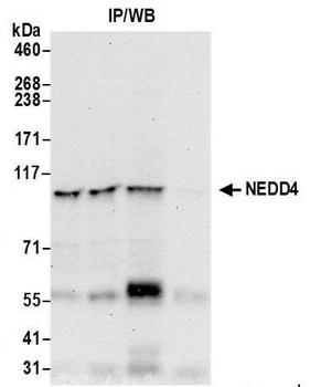 Rabbit NEDD4 Antibody