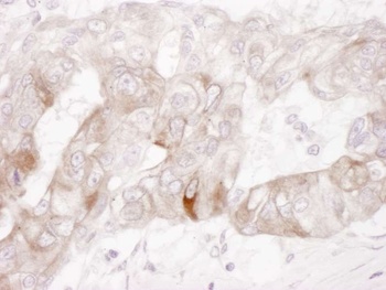 Rabbit anti-c-Kit Antibody