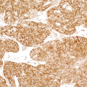 Rabbit YB1 Antibody