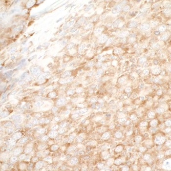 Rabbit YB1 Antibody