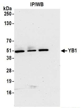 Rabbit YB1 Antibody