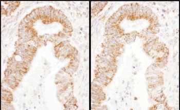 Rabbit TFAM Antibody