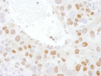 Rabbit TDP43 Antibody