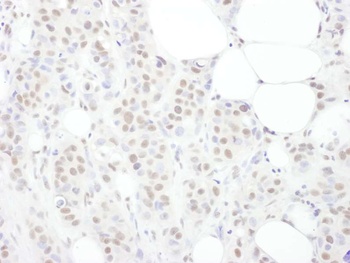 Rabbit TDP43 Antibody