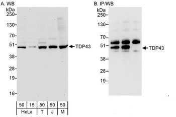 Rabbit TDP43 Antibody