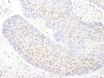 Rabbit TDP43 Antibody