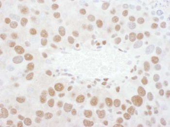 Rabbit TDP43 Antibody