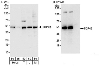 Rabbit TDP43 Antibody