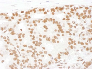 Rabbit SF1 Antibody