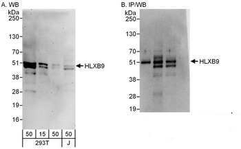 Rabbit HLXB9 Antibody