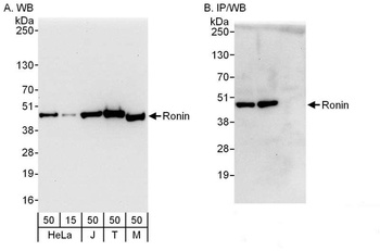 Rabbit Ronin Antibody