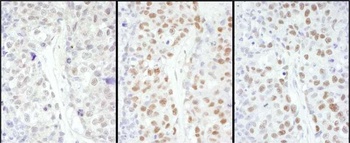 HSF1 Antibody