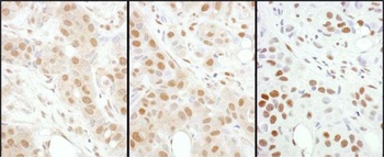 HSF1 Antibody