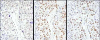 Rabbit anti-HSF1 Antibody