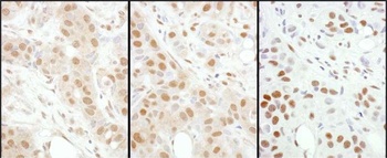 Rabbit anti-HSF1 Antibody