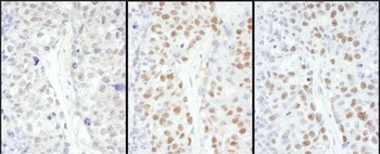Rabbit anti-HSF1 Antibody