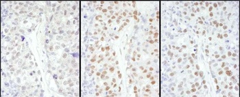 HSF1 Antibody