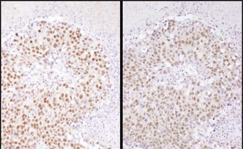 Rabbit SRF Antibody