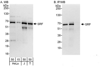 Rabbit SRF Antibody