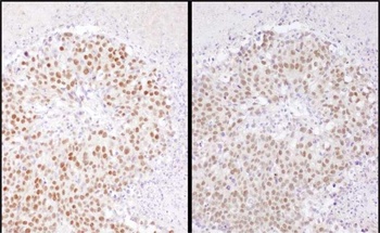 Rabbit SRF Antibody